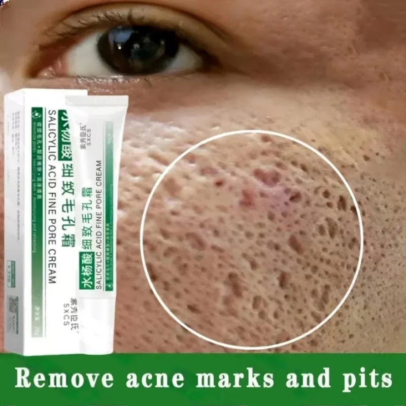 サリチル酸毛穴クリアリングクリーム毛穴を縮小黒ずみ除去にきび - Korean Skincare Routine のレビューと価格