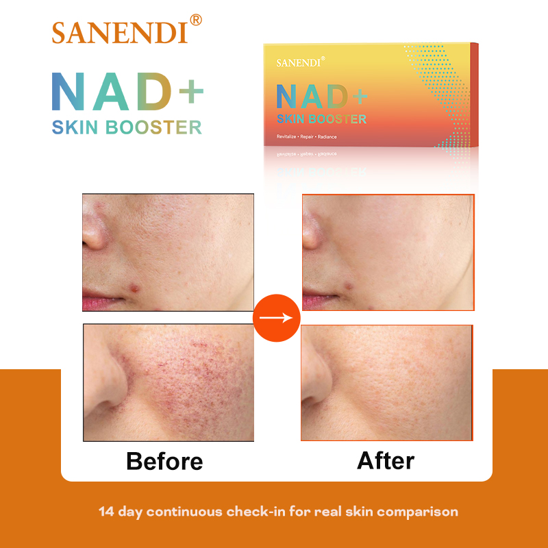 サンエンド NAD+ 韓国スキンケア製品 コンプレックスエッ - Korean Skincare Routine のレビューと価格